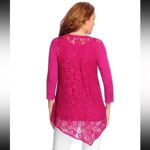 NWOT - Lace Back Asymmetrical Set